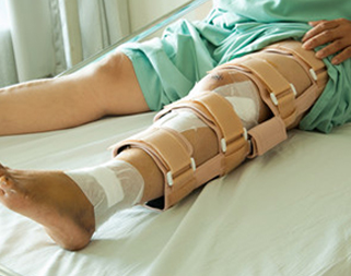 Fracture Treatment